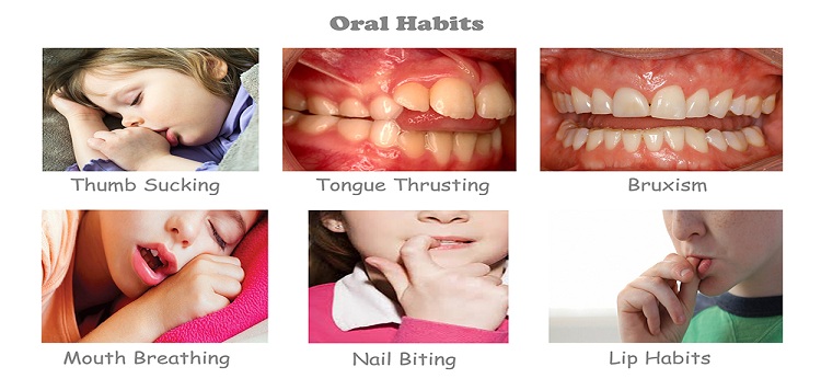 Dentalia smiles